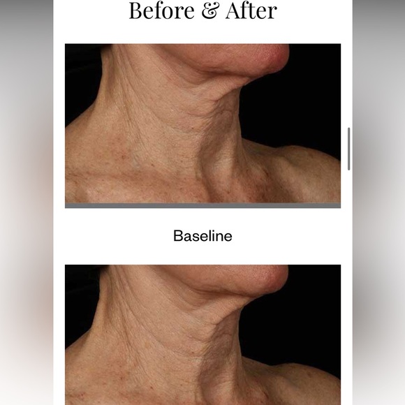 Skinmedica Neck Correct cream NIB - Picture 5 of 5